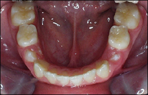 Dentofacial Orthopaedic