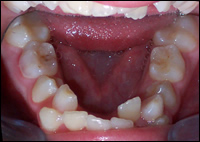 dentofacial orthopaedic