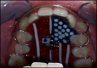 Dentofacial