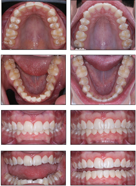 Orthodontics